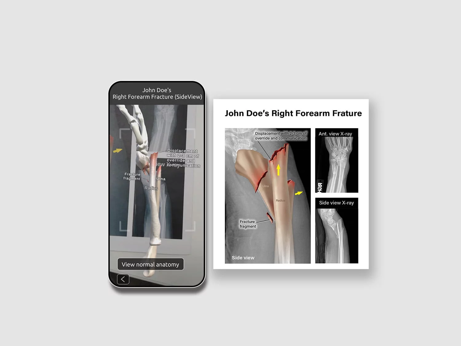 Medial Legal AR image
