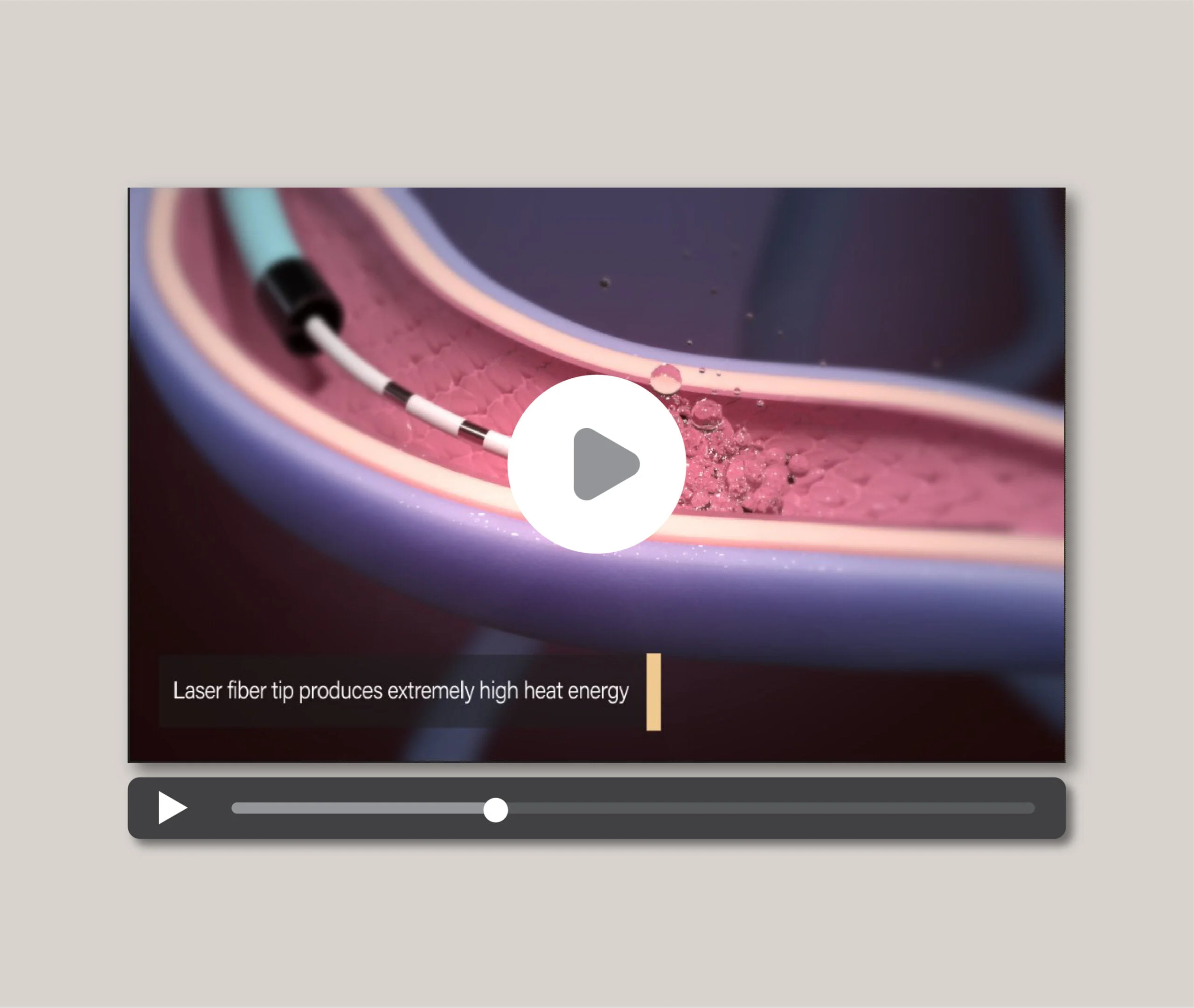 evla_thumbnail_anim-01